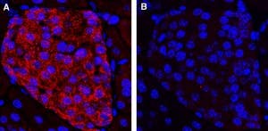 Anti-KCNK16 (TALK-1) (extracellular) Antibody