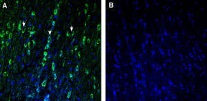 Anti-TMEM175 Antibody