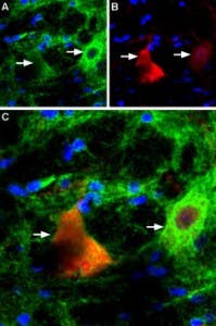 Anti-P2X4 Receptor Antibody
