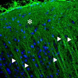 Anti-P2X2 Receptor Antibody