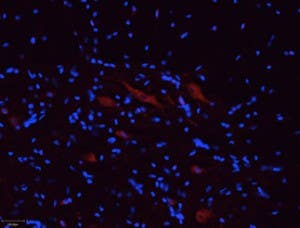 Anti-P2X5 Receptor Antibody