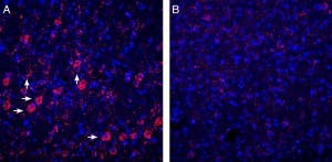 Anti-P2Y6 Receptor Antibody