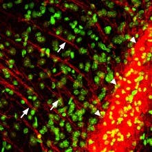 Anti-P2Y12 Receptor Antibody