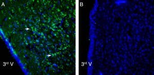 Anti-P2X6 Receptor Antibody