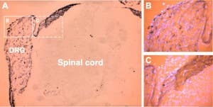 Anti-P2X3 Receptor Antibody