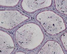 Anti-P2Y13 Receptor Antibody