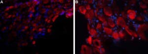 Anti-P2X3 Receptor (extracellular) Antibody
