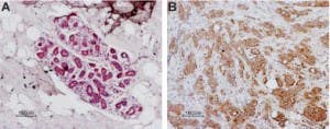 Anti-Human PAR1 (F2R) (extracellular) Antibody