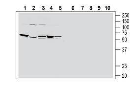 Anti-Human PAR2/F2RL1 (extracellular) Antibody