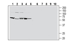 Anti-Human PAR2/F2RL1 (extracellular) Antibody - Carrier Free