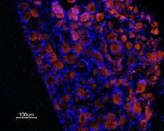 Anti-Prokineticin Receptor 1 (extracellular) Antibody