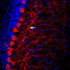 Anti-Prostaglandin E Receptor EP2/PTGER2 (extracellular) Antibody