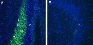 Anti-Plexin-A4 (extracellular) Antibody