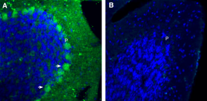Anti-Plexin-B1 (extracellular) Antibody