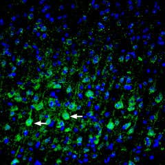 Anti-Plexin-A3 (extracellular) Antibody
