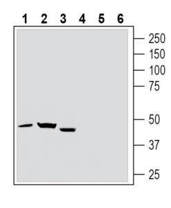 Anti-Thromboxane A2 Receptor (extracellular) Antibody