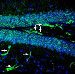 Anti-P2Y2 Receptor (extracellular) Antibody