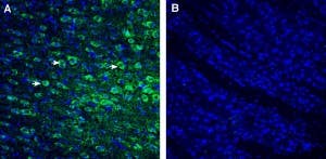 Anti-P2Y10 (extracellular) Antibody