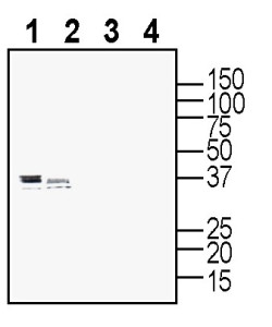 Anti-P2Y10 (extracellular) Antibody - Carrier Free