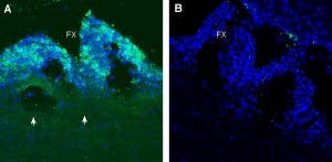 Anti-PepT2/SLC15A2 (extracellular) Antibody