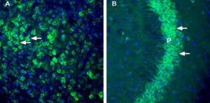 Anti-Thromboxane A2 Receptor Antibody