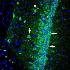 Anti-Shank1 Antibody