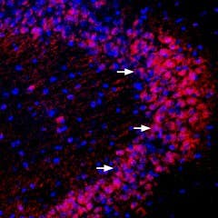 Anti-PICK1 Antibody