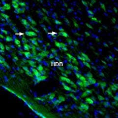 Anti-Homer3 Antibody