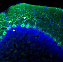 Anti-AKAP12 Antibody