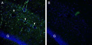 Anti-Gamma-Synuclein Antibody