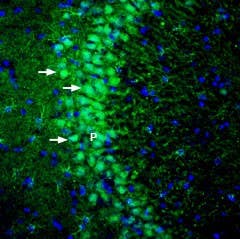 Anti-DLGAP1/GKAP Antibody