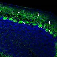 Anti-IQGAP1 Antibody