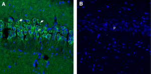 Anti-Synaptojanin 1 Antibody