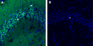 Anti-Endophilin-A1 Antibody - Carrier Free