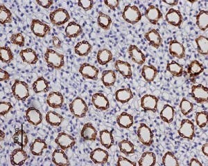 Anti-Aquaporin 2 Antibody
