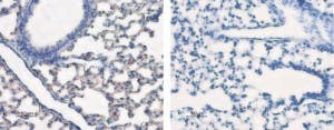 Anti-Aquaporin 5 Antibody
