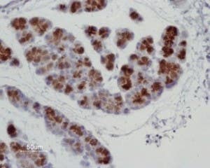Anti-Aquaporin 8 Antibody