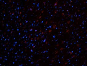 Anti-Ryanodine Receptor 3 Antibody