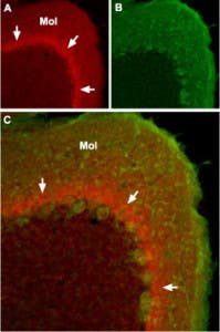 Anti-SCN1A (Na<sub>V</sub>1.1) Antibody