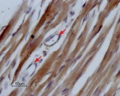 Anti-Na<sub>V</sub>1.5 (SCN5A) (493-511) Antibody
