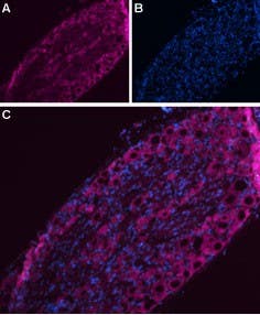 Anti-Na<sub>V</sub>1.7 (SCN9A)-ATTO Fluor-633 Antibody