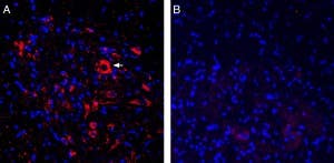 Anti-ASIC2a Antibody