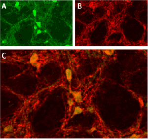 Anti-ASIC1 Antibody