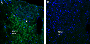 Anti-Na<sub>V</sub>1.7 (SCN9A) (extracellular) Antibody