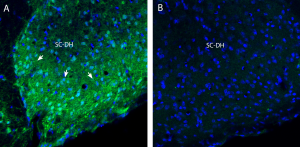 Anti-Na<sub>V</sub>1.8 (SCN10A) (extracellular) Antibody
