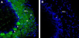 Anti-SCN1A (Na<sub>V</sub>1.1) (extracellular) Antibody