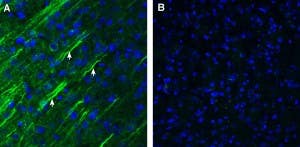 Anti-Somatostatin Receptor Type 1 (extracellular) Antibody