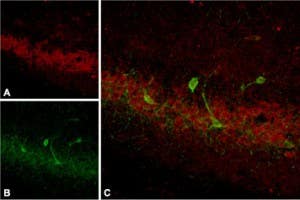 Anti-Somatostatin Receptor Type 4 (extracellular) Antibody