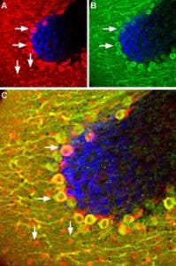 Anti-Somatostatin Receptor Type 5 (extracellular) Antibody