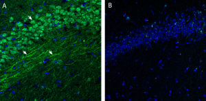 Anti-S1PR3 (EDG3) (extracellular) Antibody